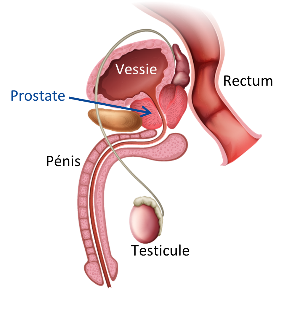 Cancer de la prostate | Eurofins Biologie Médicale