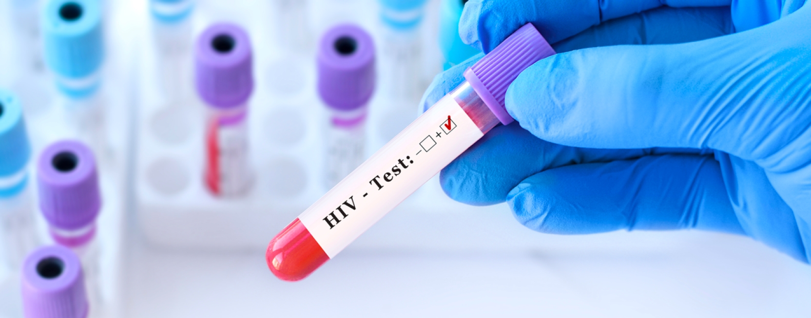 Test VIH sans ordonnance