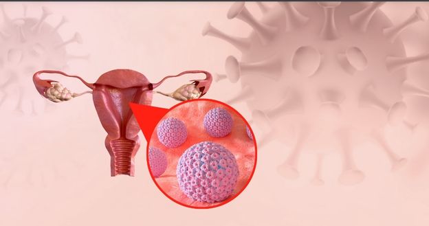 HPV et cancer du col de l’utérus
