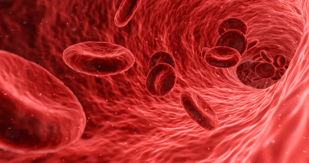 L’hémochromatose, un excès de fer dans l'organisme